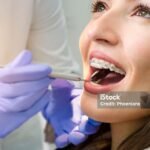 Closeup of beautiful girl with dental braces check up, satisfied smiling, while doctor looking her teeth